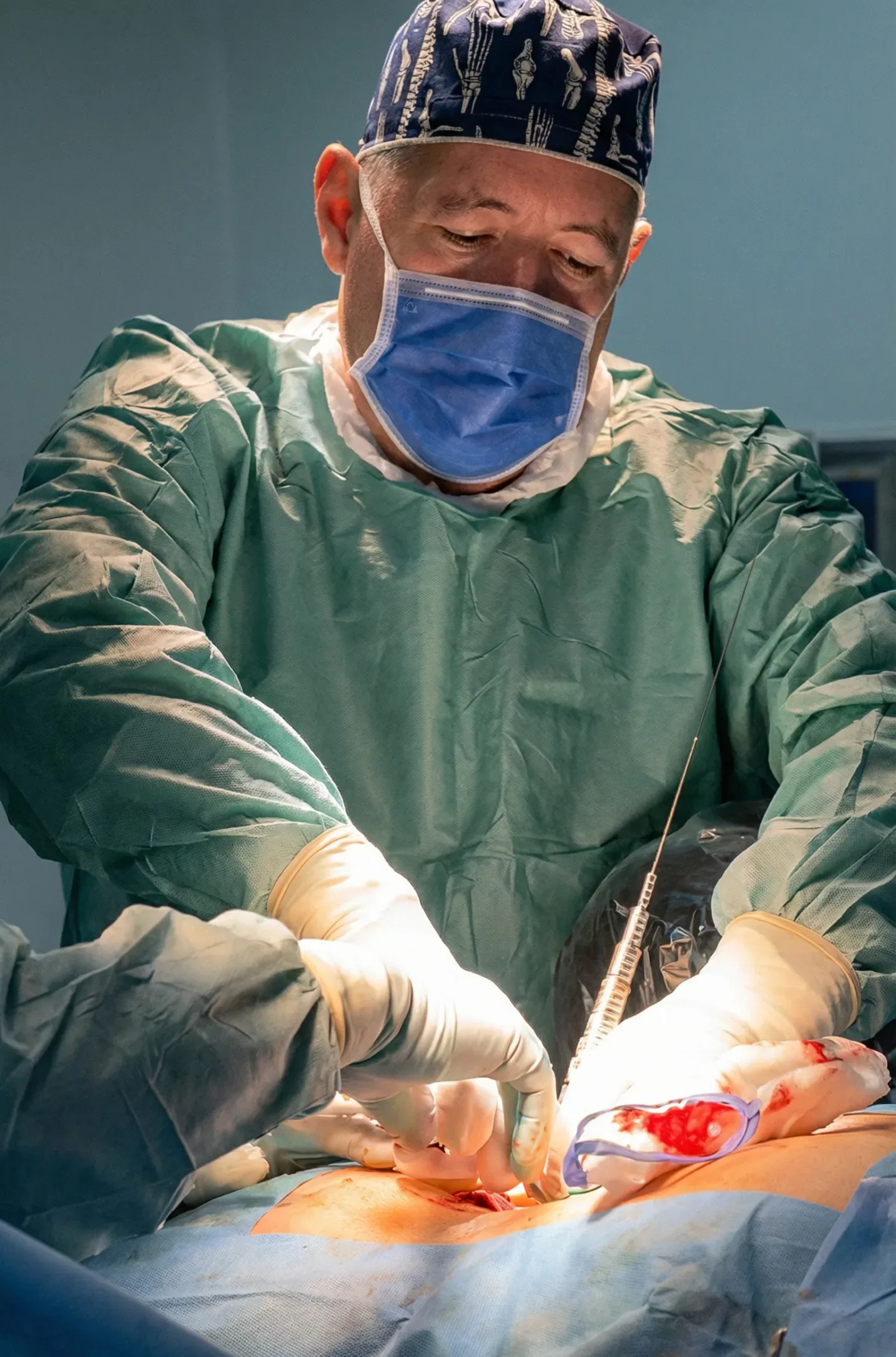 Cirugía de Columna Minimamente Invasiva - Dr. Díaz Martínez